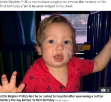 【海外発！Breaking News】酸の臭いの嘔吐、ボタン電池誤飲の1歳男児「あと少し遅かったら命はなかった」（英）