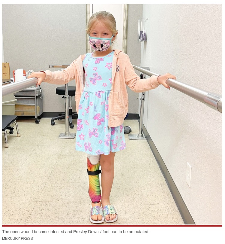 1歳の時に片脚を切断、現在7歳になる少女（画像は『New York Post　2021年10月29日付「My little girl went in for a mole removal and ended up having her foot amputated」（MERCURY PRESS）』のスクリーンショット）