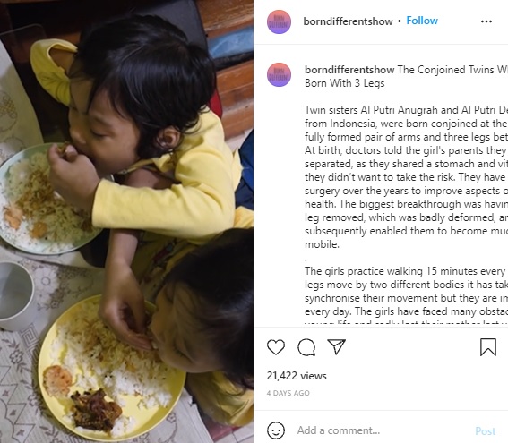 祖母が作った料理を食べる2人（画像は『Born Different　2021年9月28日付Instagram「The Conjoined Twins Who Were Born With 3 Legs」』のスクリーンショット）