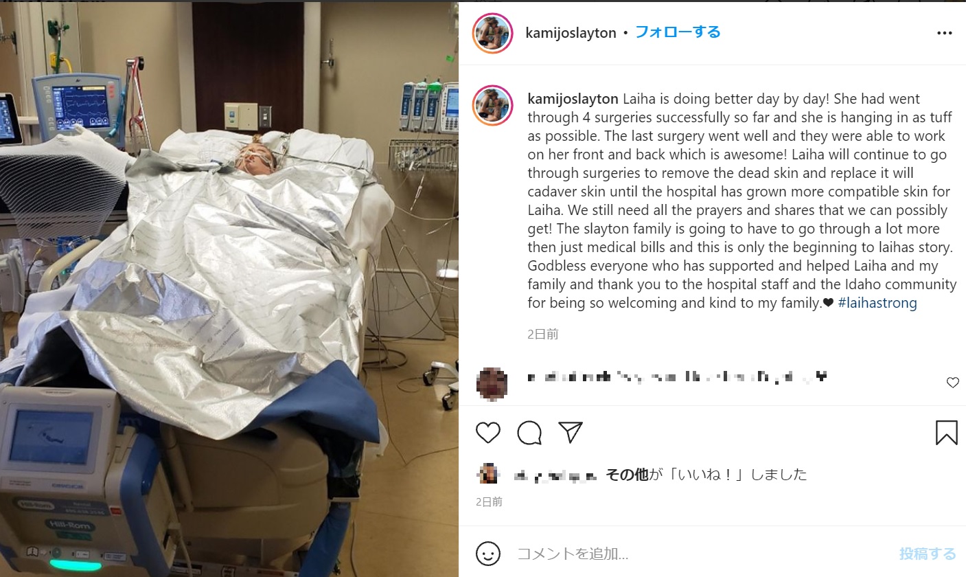 現在も意識不明のレイハさん（画像は『Kami Slayton　2021年10月11日付Instagram「Laiha is doing better day by day!」』のスクリーンショット）