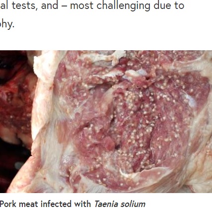 有鉤条虫に感染した豚肉（画像は『BMC blog network　2016年12月1日付「HIV and pork tapeworm: Does one disease affect the other?」』のスクリーンショット）