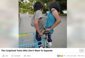 大人用の三輪車に乗る2人（画像は『Born Different　2021年11月3日付Facebook「Conjoined twins Pin and Pan don’t want to be separated」』のスクリーンショット）