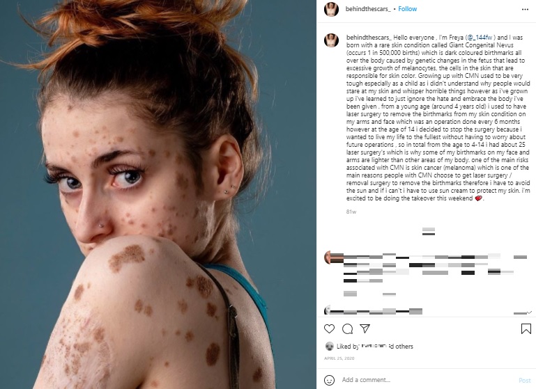「自分に自信が持てるようになった」という女性（画像は『Behind The Scars　2020年4月25日付Instagram「Hello everyone」』のスクリーンショット）