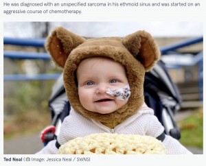 手術を受ける予定のテッド君（画像は『The Mirror　2021年12月11日付「Baby diagnosed with rare cancer after parents thought he had sand in his eye」（Image: Jessica Neal / SWNS）』のスクリーンショット）