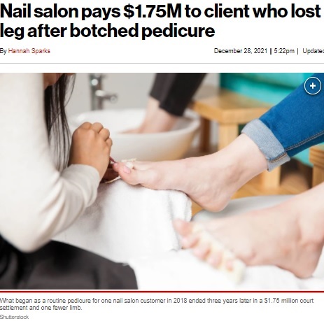 ネイルサロンでできた傷でまさかの脚切断（画像は『New York Times　2021年12月28日付「Nail salon pays ＄1.75M to client who lost leg after botched pedicure」（Shutterstock）』のスクリーンショット）