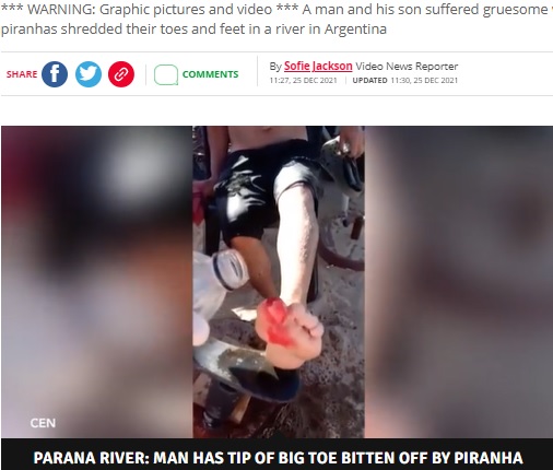 親指の先端を食いちぎられた父親（画像は『The Daily Star　2021年12月25日付「Man’s big toe eaten by piranhas after going for a dip in infested river with son」（Image: CEN）』のスクリーンショット）