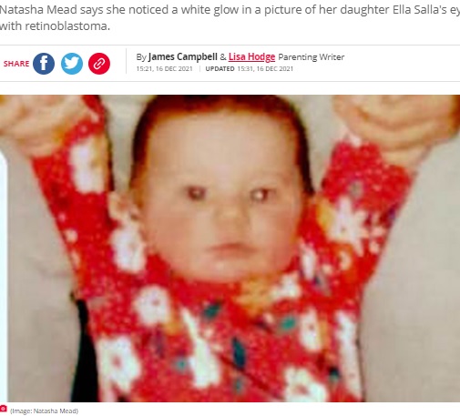 目が白く光る生後6か月の頃の女児（画像は『The Daily Record　2021年12月16日付「Mum's warning over 'glowing eye' in photo that could be deadly sign of cancer」（Image: Natasha Mead）』のスクリーンショット）