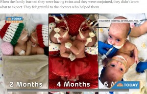 どんどんたくましくなる2人（画像は『TODAY　2022年1月21日付「These conjoined twins were separated in a 10-hour surgery - and they’re thriving」（Courtesy Altobelli Family）』のスクリーンショット）