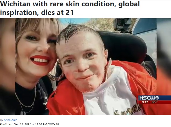 21歳で亡くなったマーキーさんと母メリッサさん（画像は『KWCH　2021年12月31日付「Wichitan with rare skin condition, global inspiration, dies at 21」』のスクリーンショット）