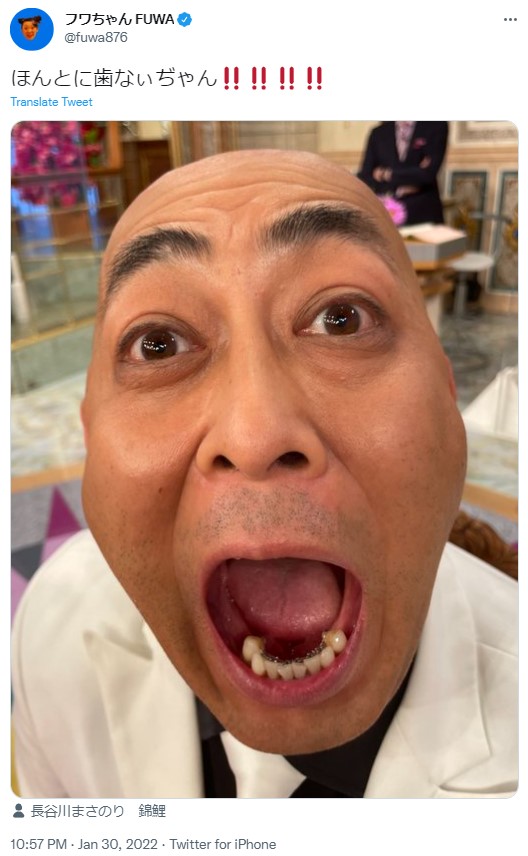 下の歯は8本しか残っていない錦鯉・長谷川（画像は『フワちゃん FUWA　2022年1月30日付Twitter「ほんとに歯なぃぢゃん!!」』のスクリーンショット）