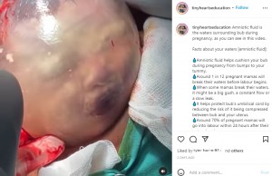 卵膜と羊水に包まれた被膜児（画像は『Follow for EMPOWERMENT　2022年3月1日付Instagram「Amniotic fluid is the waters surrounding bub during pregnancy」』のスクリーンショット）