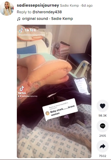 まるでベイビーシャーク？（画像は『Sadie Kemp　2022年3月17日付TikTok「Reply to ＠sharonday438」』のスクリーンショット）