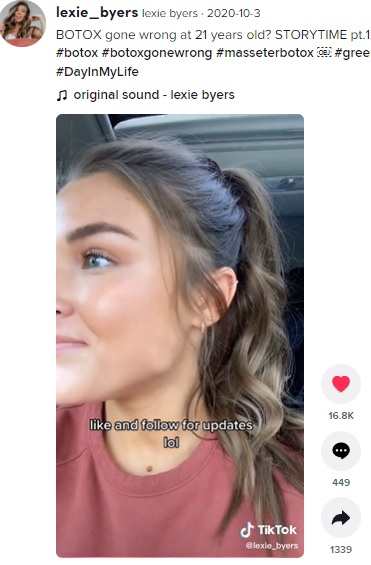 まるで卓球用ボールを入れたよう？（画像は『lexie byers　2020年10月3日付TikTok「BOTOX gone wrong at 21 years old?」』のスクリーンショット）