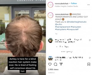 地肌が露出していたアシュリーさんの後頭部（画像は『Novo Cabelo　2022年3月4日付Instagram「AMAZING TRANSFORMATION AND LOVELY GUY ASHLEY」』のスクリーンショット）