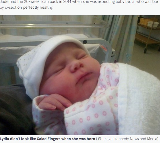2014年に元気に誕生した女児（画像は『The Mirror　2022年4月8日付「Mum scared of unborn ‘demon child’ as baby looks like ‘Salad Fingers’ in scan」（Image: Kennedy News and Media）』のスクリーンショット）