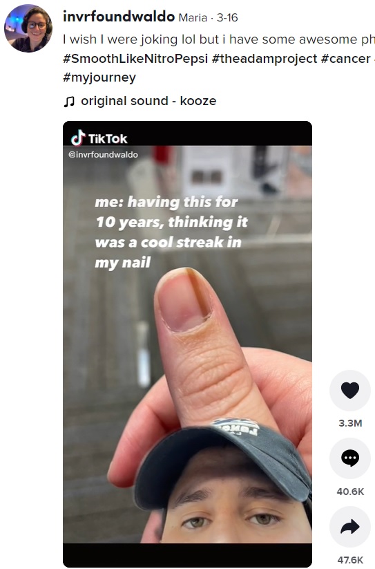 爪にできた線は皮膚がんの一種「メラノーマ」だった（画像は『Maria　2022年3月16日付TikTok「I wish I were joking lol but i have some awesome photos」』のスクリーンショット）