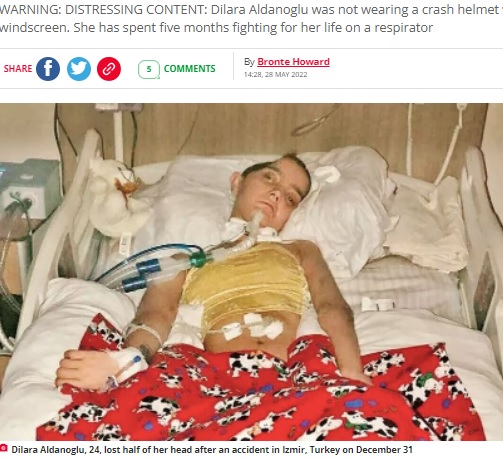 寝たきりになってしまったディラーラさん（画像は『The Daily Star　2022年5月28日付「Tragic university researcher, 24, loses half her head after horror motorcycle crash」』のスクリーンショット）