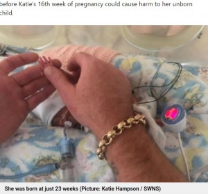 【海外発！Breaking News】妊娠23週で誕生　手の大きさが父の親指の爪と同じだった女児、来月で1歳に（英）