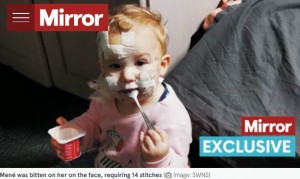 14針を縫う重傷だったメニーちゃん（画像は『The Mirror　2022年5月28日付「EXCLUSIVE: Toddler’s horror injuries after ‘perfect’ family dog tries to rip her face off」（Image: SWNS）』のスクリーンショット）