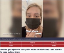 【海外発！Breaking News】薄眉に悩んでいた女性、頭髪を眉毛に移植　「どんどん伸びてくるけど満足」と語る（英）＜動画あり＞