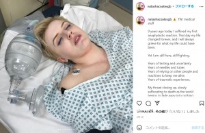 これまで500回以上の入院を経験したという女性（画像は『Natasha Coates　2022年5月28日付Instagram「TW: medical stuff」』のスクリーンショット）