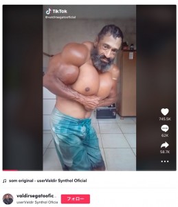 医師の忠告を無視してオイル注入を続けたヴァウジールさん（画像は『userValdir Synthol Oficial　2022年6月10日付TikTok』のスクリーンショット）