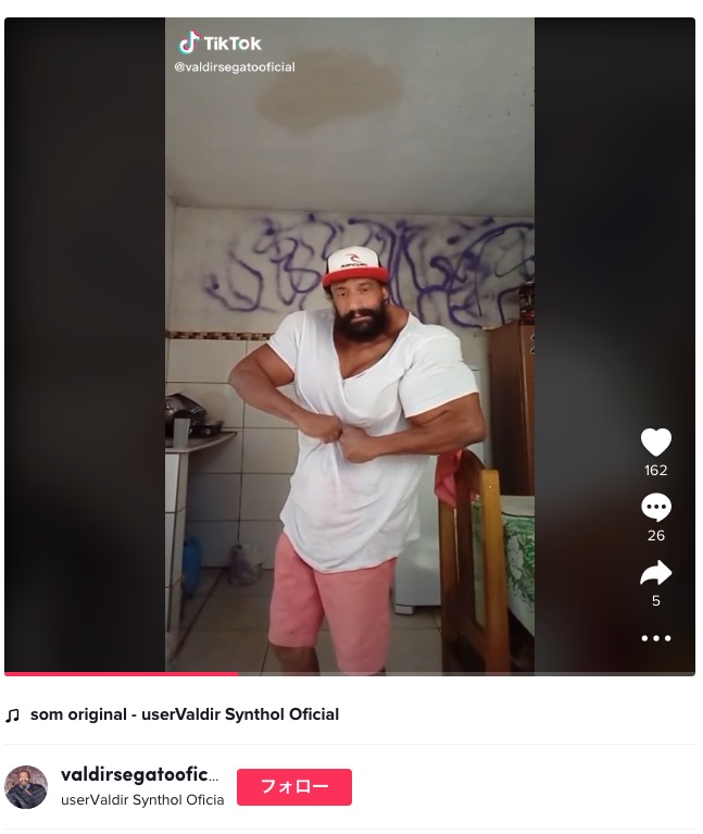 腕にオイルを注入し続けたボディービルダー（画像は『userValdir Synthol Oficial　2022年5月25日付TikTok』のスクリーンショット）