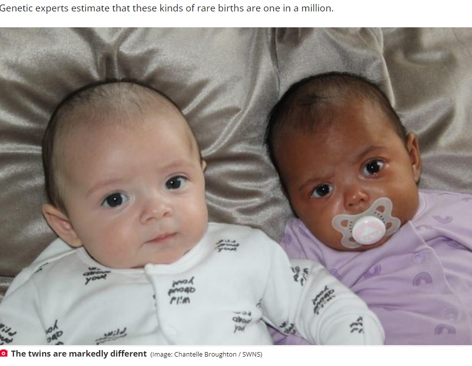 成長とともに肌の色の違いがより分かるように（画像は『The Daily Star　2022年8月19日付「Shocked mum gives birth million-to-one white and black twins with different skin colours」（Image: Chantelle Broughton / SWNS）』のスクリーンショット）