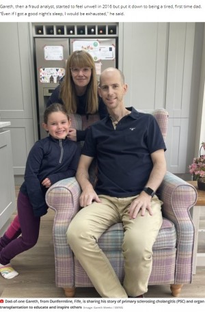 【海外発！Breaking News】肝臓移植を受けた父のビフォー・アフター写真、劇的変化に娘もスマイル（スコットランド）