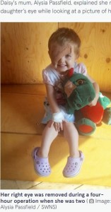 2歳で手術を受けたデイジーちゃん（画像は『The Mirror　2022年8月30日付「Girl, 8, receives ‘sparkly ‘superhero’ eye after battling rare cancer as a baby」（Image: Alysia Passfield / SWNS）』のスクリーンショット）