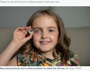今までは左目と同じ色だった義眼（画像は『The Mirror　2022年8月30日付「Girl, 8, receives ‘sparkly ‘superhero’ eye after battling rare cancer as a baby」（Image: SWNS）』のスクリーンショット）