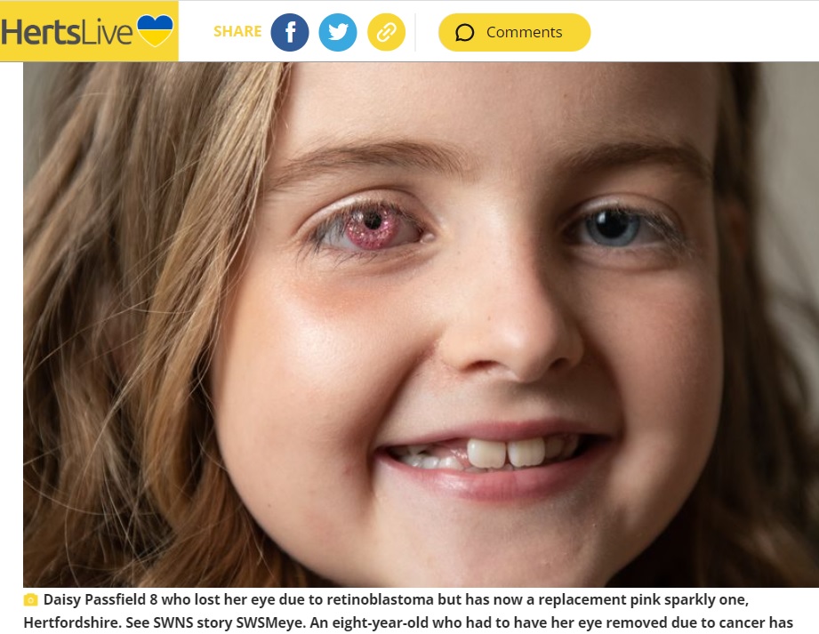 キラキラ輝くピンク色の義眼を装着したデイジーちゃん（画像は『Hertfordshire Mercury　2022年8月30日付「Abbots Langley girl gets pink sparkly ‘superhero eye’ after retinoblastoma cancer battle」（Image: SWNS）』のスクリーンショット）