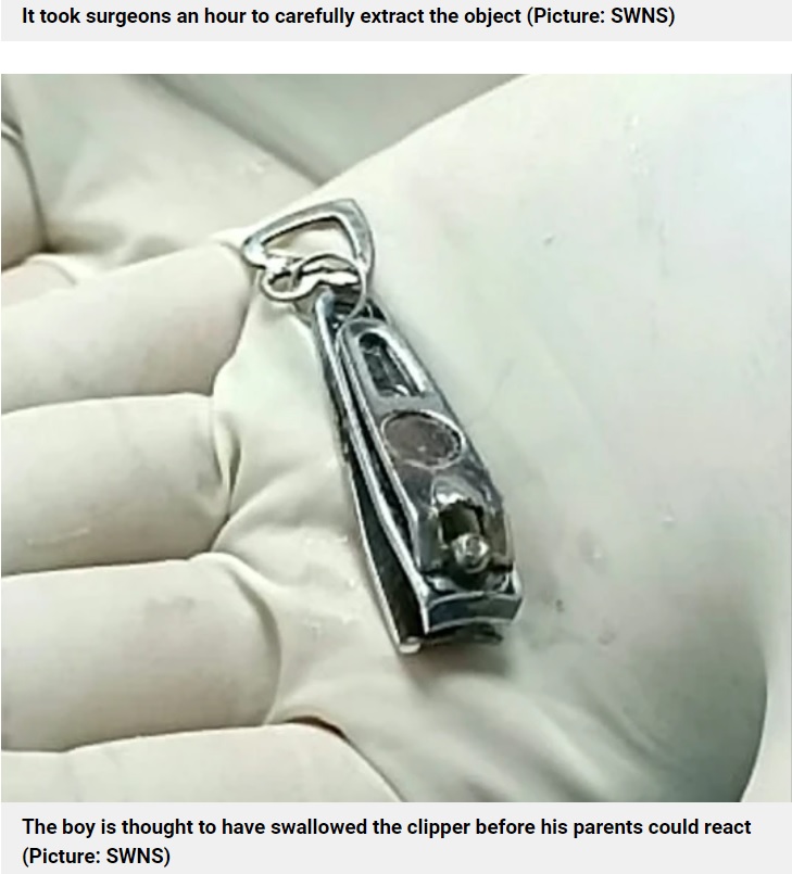 摘出された爪切り（画像は『Metro　2022年9月24日付「Baby accidentally swallows nail clipper and has to have surgery to remove it」（Picture: SWNS）』のスクリーンショット）