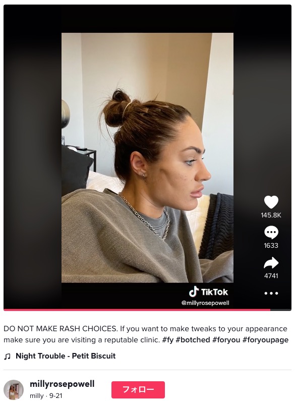 悪質な美容クリニックについて警鐘を鳴らしたミリーさん（画像は『milly　2022年9月21日付TikTok「DO NOT MAKE RASH CHOICES.」』のスクリーンショット）