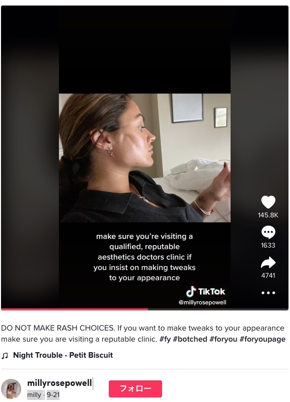 「まるでギャングスター」と言われてしまったことも（画像は『milly　2022年9月21日付TikTok「DO NOT MAKE RASH CHOICES.」』のスクリーンショット）