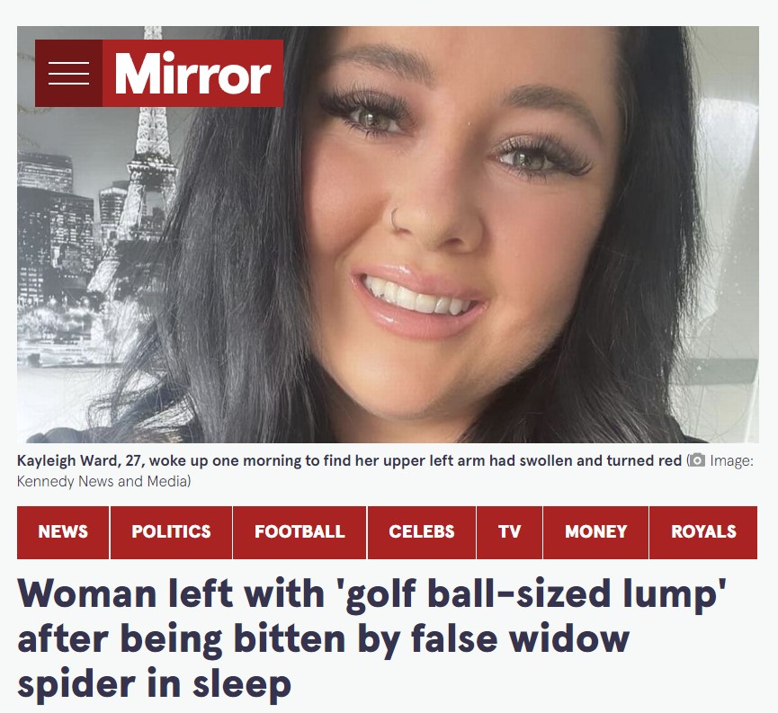 就寝中にクモに噛まれた女性（画像は『The Mirror　2022年10月7日付「Woman left with ‘golf ball-sized lump’ after being bitten by false widow spider in sleep」（Image: Kennedy News and Media）』のスクリーンショット）