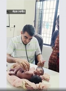 専門家チームによる検査を受けている双子（画像は『Dainik Bhaskar　2022年10月7日付「दो सिर, चार-चार हाथ पैर, सीने से जुड़े बच्चे जन्मे:AIIMS जांच करेगा अलग होंगे या नहीं, अभी दोनों स्वस्थ」』のスクリーンショット）