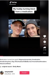 白人男性の肌の色だったタイラーさん（左）（画像は『Emily Monk　2022年8月18日付TikTok「Medication turned him grey!!」』のスクリーンショット）