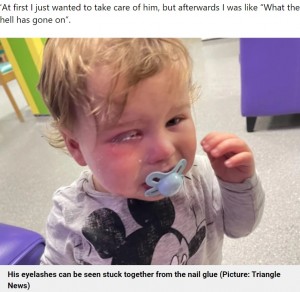 目にネイルグルーがべっとりついたジャック君（画像は『Metro　2022年10月19日付「Toddler’s eyes glued shut when nursery worker did nails while holding him」（Picture: Triangle News）』のスクリーンショット）