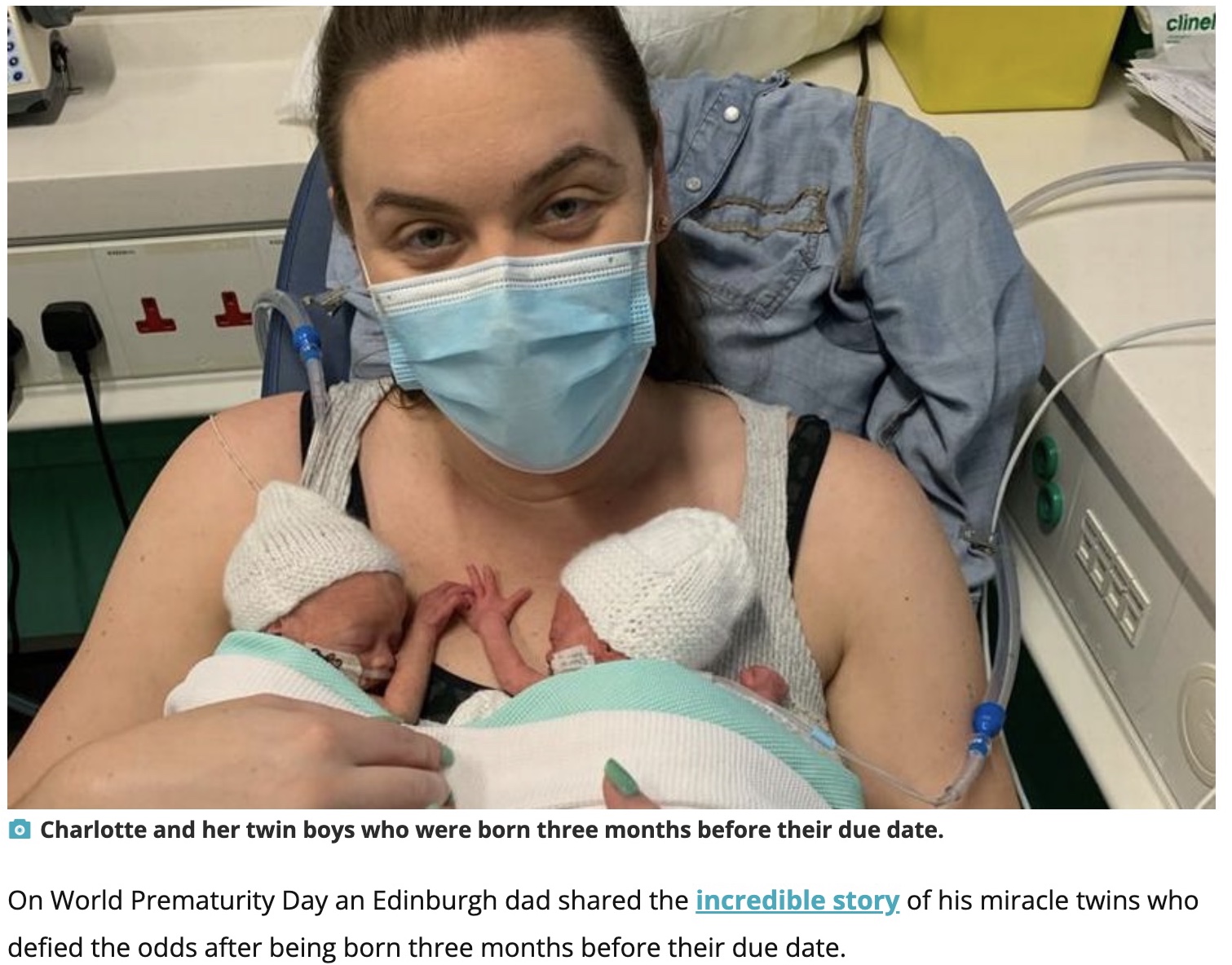 予定日より3か月早く誕生した双子の男児（画像は『Edinburgh Live　2022年11月18日付「Edinburgh miracle twins defy the odds after being born three months early」』のスクリーンショット）