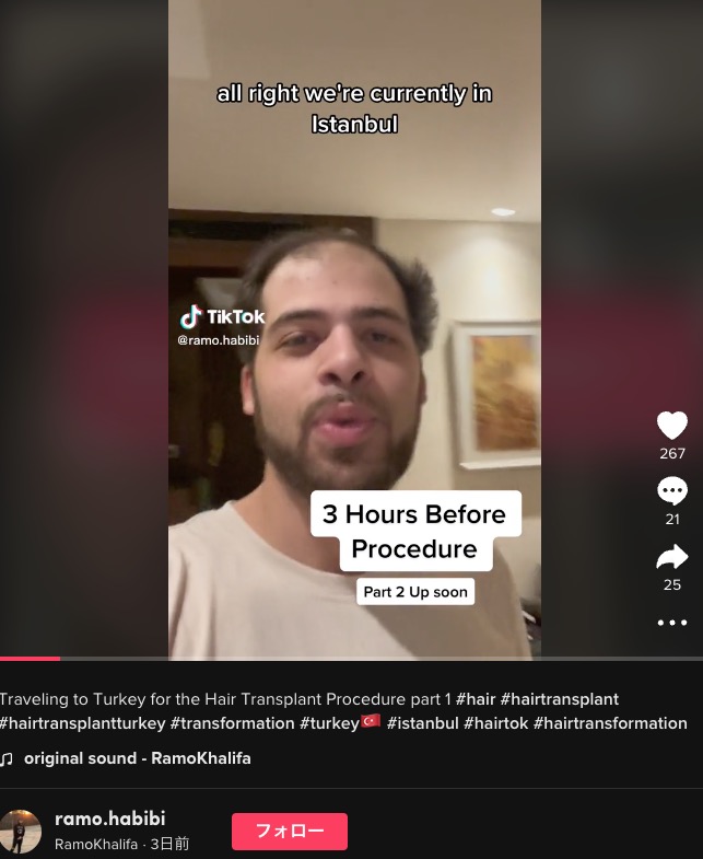 植毛手術をする前のラモさん（画像は『RamoKhalifa　2022年12月1日付TikTok「Traveling to Turkey for the Hair Transplant Procedure part 1」』のスクリーンショット）