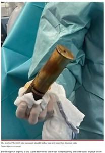 男性患者の体内から摘出した砲弾（画像は『New York Post　2022年12月20日付「Man with WWI explosive lodged in his rectum sparks bomb scare, hospital evacuation」（Twitter / ＠acommonlawyer）』のスクリーンショット）