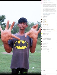 変形した大きな手（画像は『Born Different　2021年9月25日付Instagram「I Have India’s Biggest Hands」』のスクリーンショット）