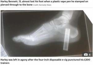 レントゲン写真にはっきりと写った電子タバコ（画像は『The Irish Sun　2022年12月22日付「PIERCING PAIN Doctors told my son, 13, he could lose his foot after he stepped on a plastic vape - it went right through his flesh」』のスクリーンショット）