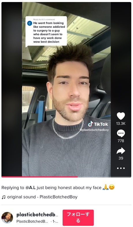 「フォックスアイ・リフト」の施術を受ける前の男性（画像は『PlasticBotchedBoy　2023年1月15日付TikTok「Replying to ＠A.L just being honest about my face」』のスクリーンショット）