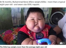 【海外発！Breaking News】1歳4か月の男児、体重が8歳並みの27キロに！　「練乳を与えていた」と母（インドネシア）＜動画あり＞