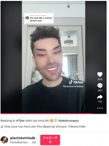 つり上がった目になったデイヴィッドさん（画像は『PlasticBotchedBoy　2023年2月10日付TikTok「Replying to ＠Tyler didnt last long tbh」』のスクリーンショット）