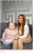 【海外発！Breaking News】「常に空腹」5歳で体重44キロ超え　娘の遺伝子疾患に苦悩する母親（英）