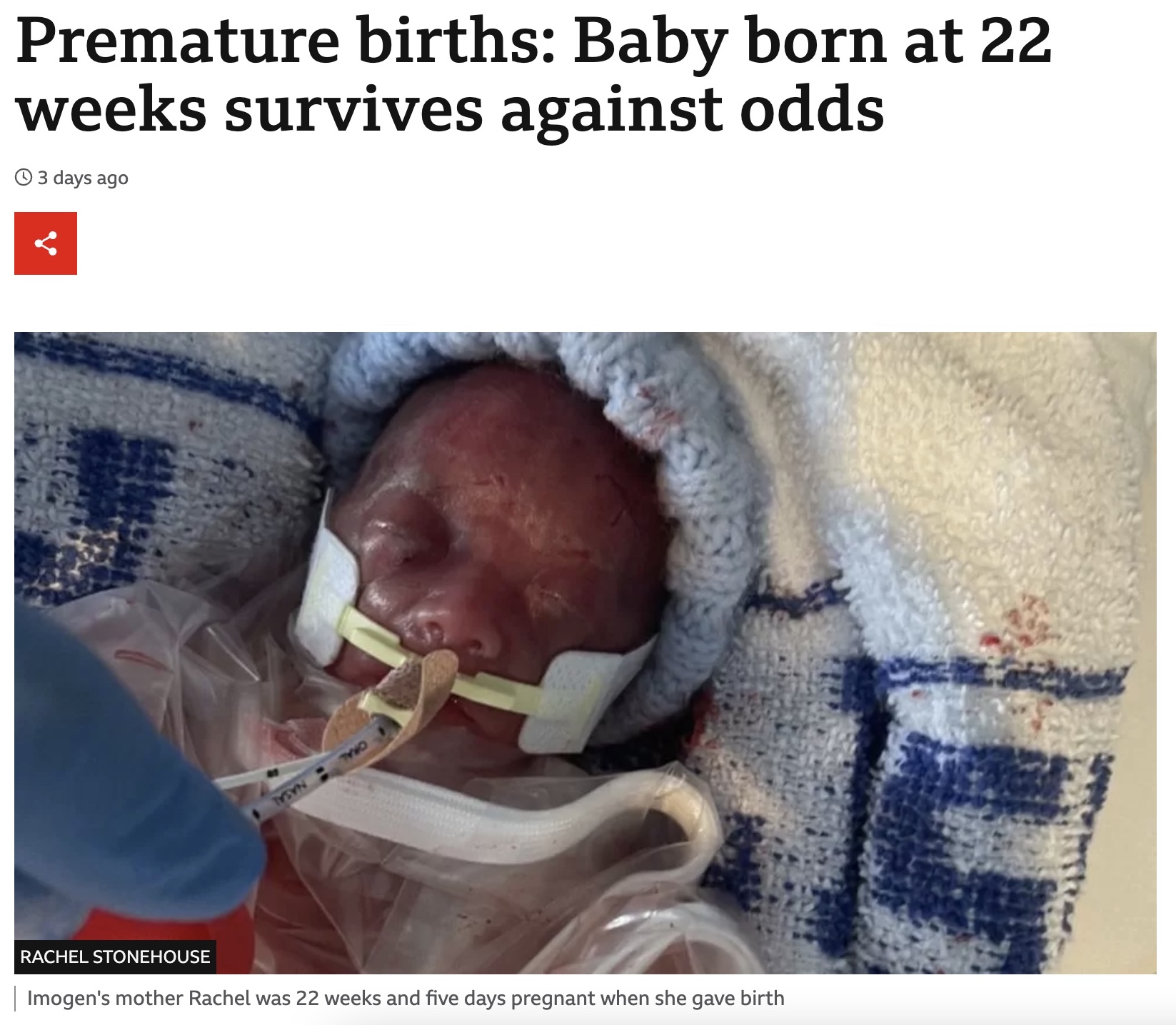 体重515グラムで誕生したイモジェンちゃん（画像は『BBC　2023年3月11日付「Premature births: Baby born at 22 weeks survives against odds」（RACHEL STONEHOUSE）』のスクリーンショット）