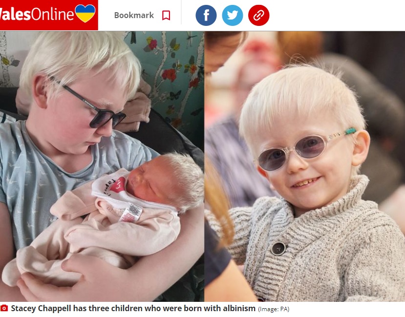 特徴的な外見と視覚障がいを持つアルビノのきょうだい（画像は『WalesOnline　2023年3月15日付「‘People make rude and nasty comments about my three albino children’」（Image: PA Real Life）』のスクリーンショット）